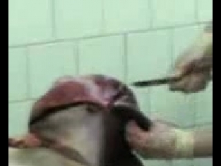 video вскрытие в морге шняга sex
