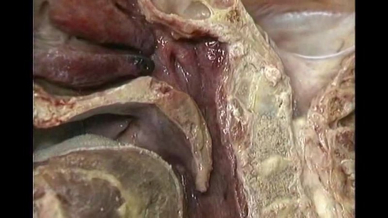 video small aclands dvd atlas human anatomy 4of6 head and neck part 1 mp3 wogre sex