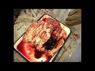 video техника вскрытия трупов tech autopsy sex