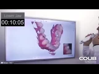 video digital evaluation of dental arch parameters 3d dental scanners sex