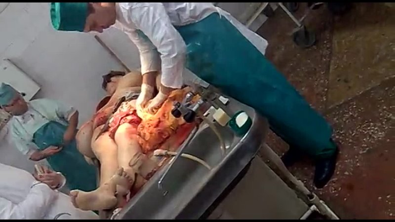 video вскрытие в морге sex