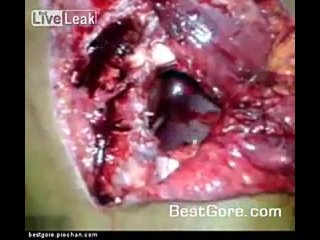 video сальвадор член банды ms 13 и дыра в груди от выстрела из дробовика sex