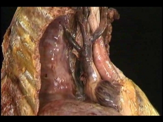 video ev aclands dvd atlas human anatomy 3of6 the trunk divx6 mp3 wogre sex