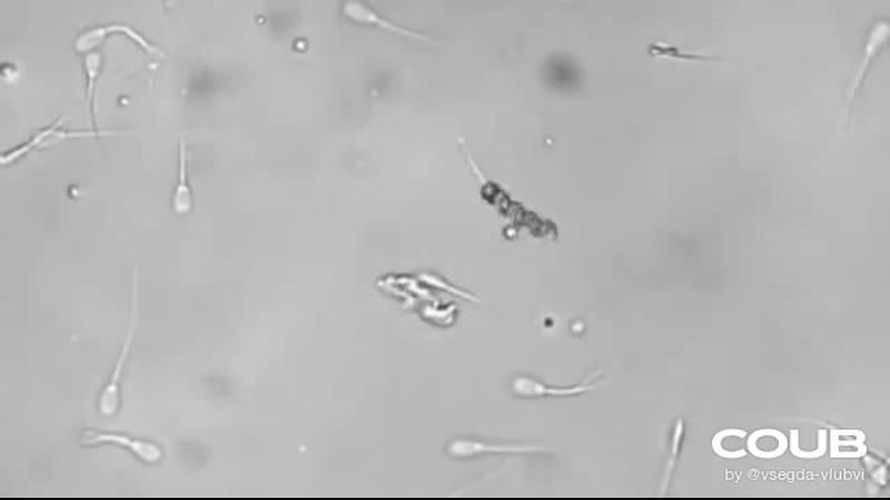 video наноробот nanorobot выполняет искусственное оплодотворение яйцеклетки sex