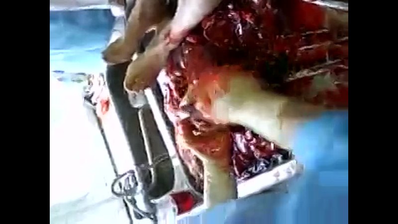 video расчленёнка в морге sex