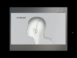 video илон маск готовит наночипы в привиах от коронавируса sex