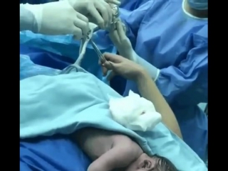 video мама захотела поучаствовать в процессе кесарево сечения sex