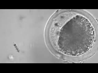 video наноробот выполняет искусственное оплодотворение яйцеклетки sex