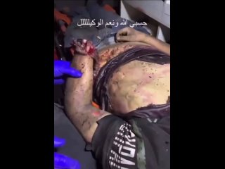 video результаты удара израиля по баптистской больницу в газе sex