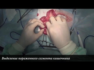 video резекция и анастомоз кишечника у кота intestinal resection in cat sex